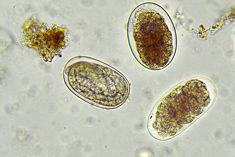 Hookworms Microscopic view of hookworms.