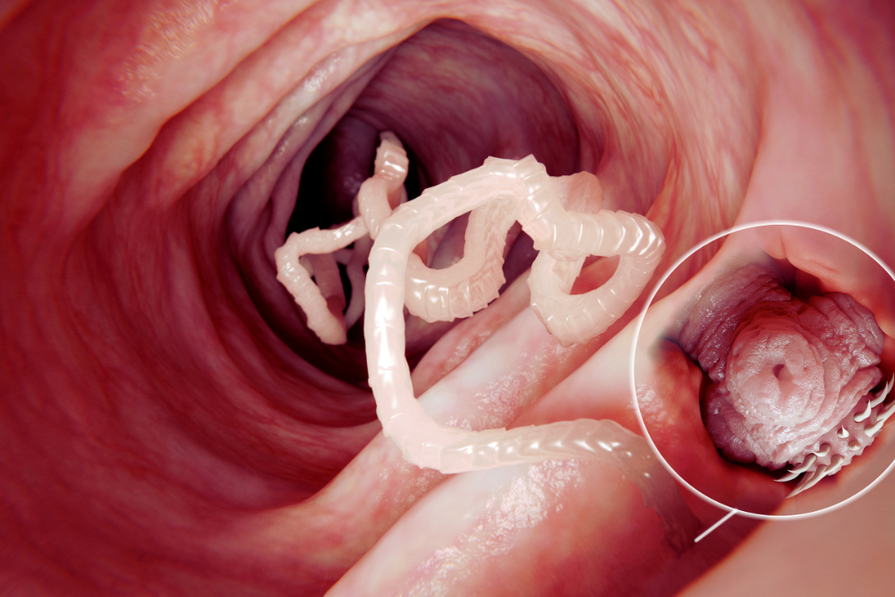 Tapeworms Tapeworms inside intestines